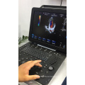 Clear Imaging Digital 4D Color Doppler Echocardiographie Cardiac USG Portable Ultrasound Machine